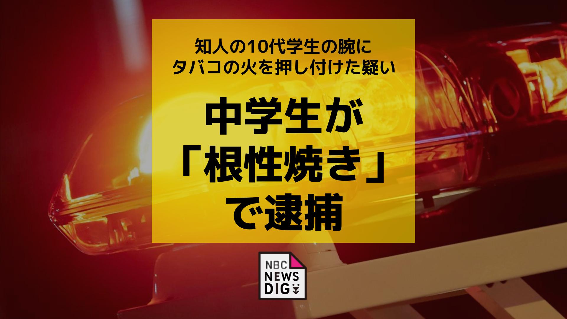 14歳の男子中学生が、友人の10代学生にタバコで根性焼き