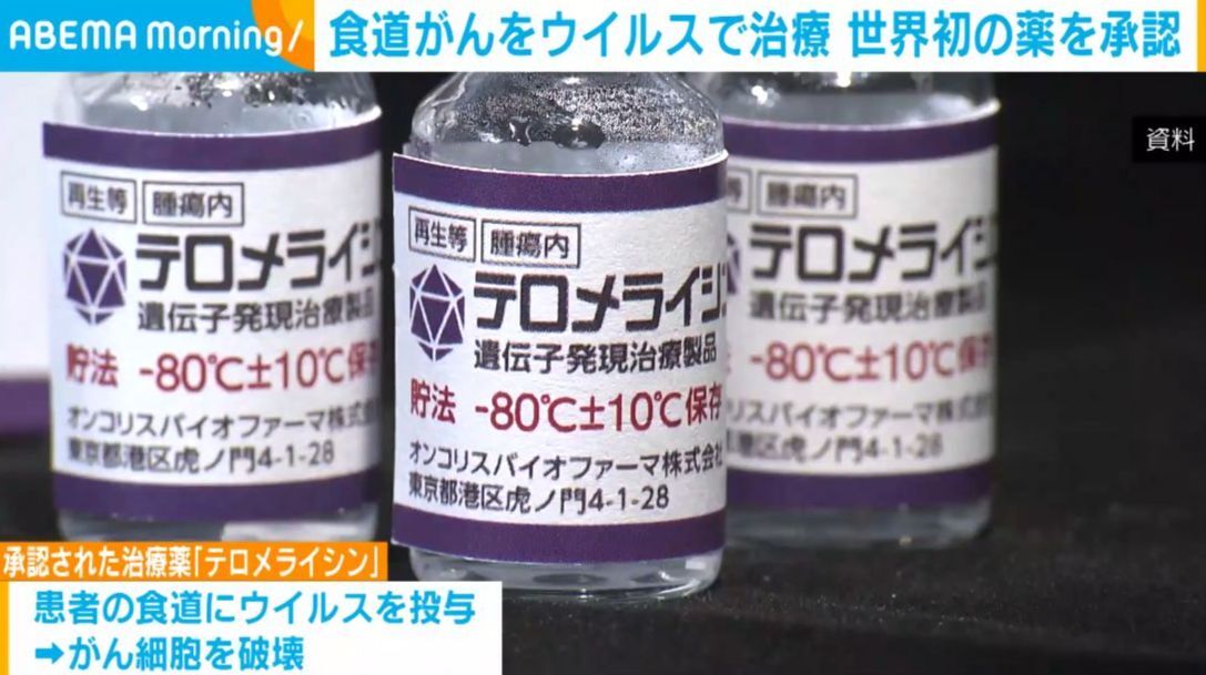 【朗報】食道がん向けウイルス治療薬世界初承認、年内販売→18ヶ月以内に半数の患者がん消失