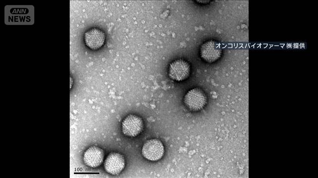 【朗報】次世代ウイルス療法 (ガン破壊ウイルス)、生存率40%食道ガン向けに年内販売開始！