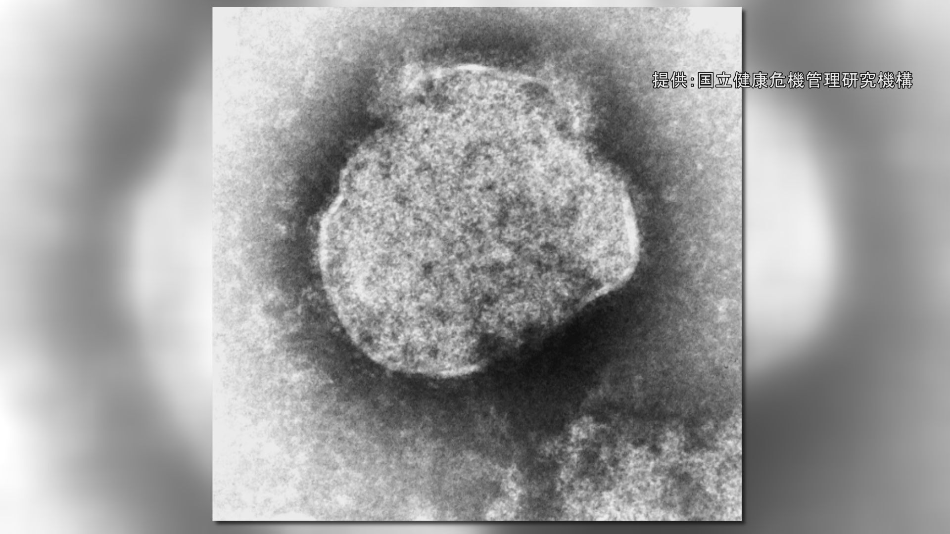 はしか感染 昨年同時期の約4.4倍　去年1年間の感染者数265人をすでに上回って362人