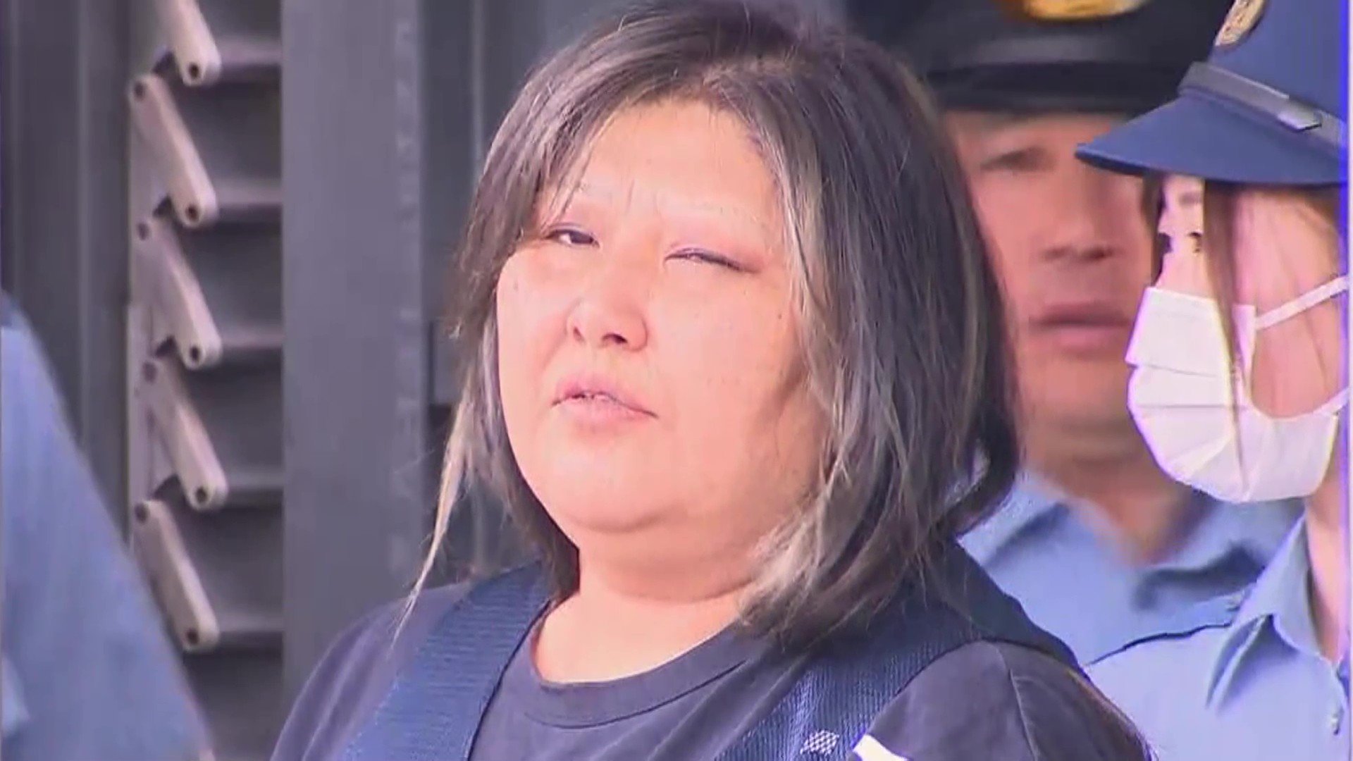 同居女性の唇を縫い合わせた女、顔面開示